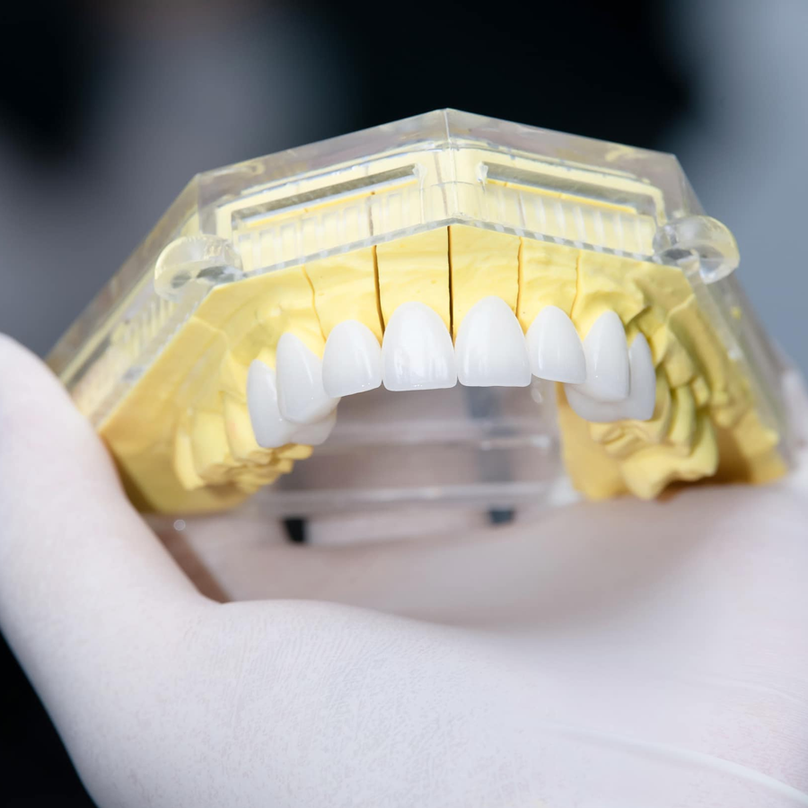 Răng sứ SAPPHIRE ZIRCONIA