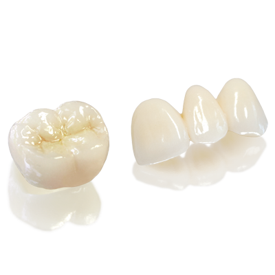 Phục hình răng trên Implant