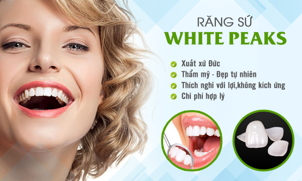 RĂNG TOÀN SỨ WHITEPEAKS