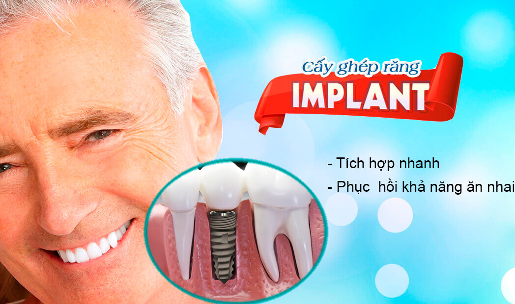 PHỤC HÌNH IMPLANT TRÊN ABUTMENT