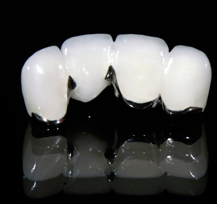 RĂNG SỨ CROMCOBALT